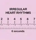 Calculate Heart Rate from ECG