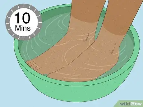 Image titled Use Foot Baths for Athlete’s Foot Step 17