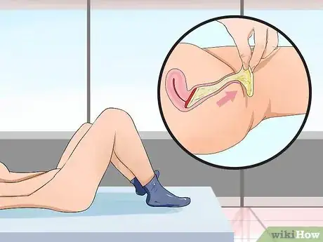 Image titled Remove a Condom Stuck Inside Step 10