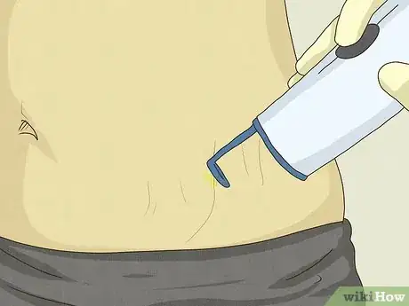 Image titled Get Rid of Stretch Marks Step 8