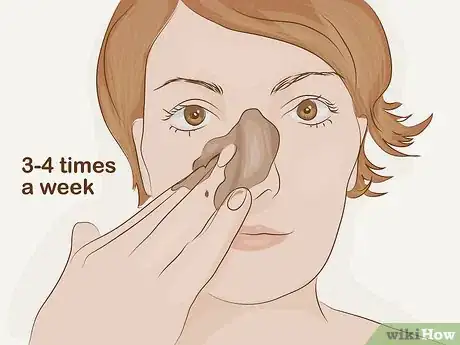 Image titled Reduce Pore Size on Your Nose Step 3