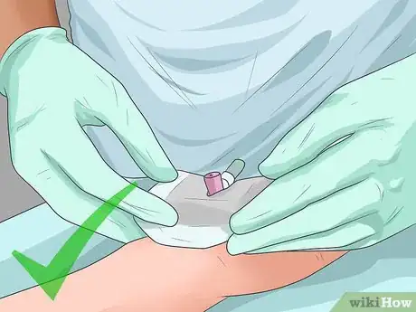 Image titled Insert a Cannula Step 10