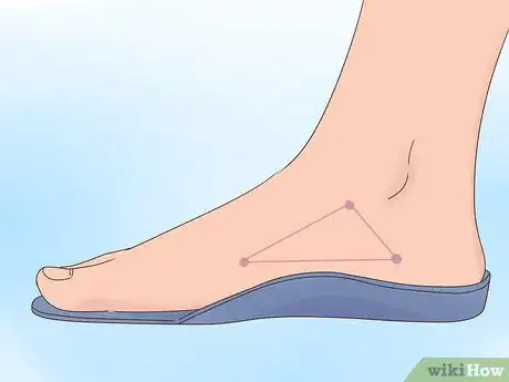 Image titled Fix Pronated Feet Step 2