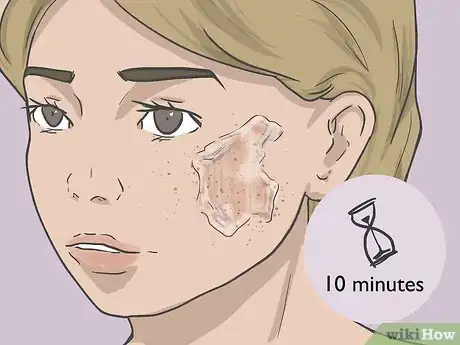 Image titled Bleach Skin with Peroxide Step 11