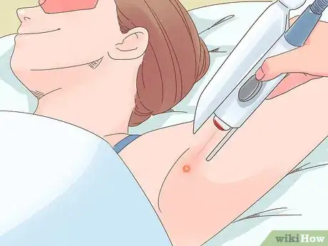 Image titled Prevent Ingrown Hairs After Shaving Step 14