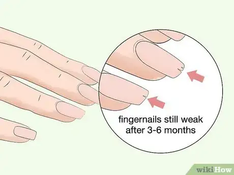 Image titled Strengthen Weak Fingernails Naturally Step 14