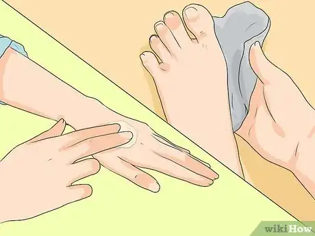 Image titled Get Rid of Calluses Step 4