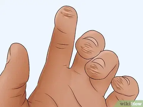 Image titled Make Your Fingers Hard for Guitar Step 10