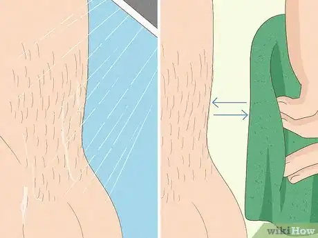 Image titled Remove Male Pubic Hair Without Shaving Step 15