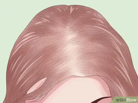 Image titled Prevent Hair Loss Due to Stress Step 1