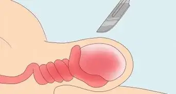 Treat Pain and Swelling in the Testicles