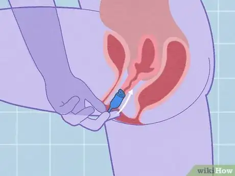 Image titled Use a Menstrual Cup Step 8