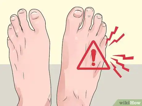 Image titled Check Feet for Complications of Diabetes Step 2
