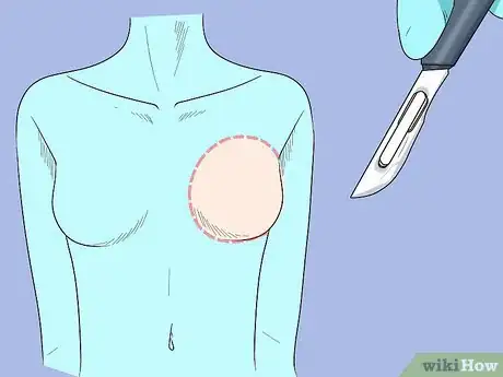 Image titled Make Breasts Look Firm Under Clothes Without a Bra Step 8