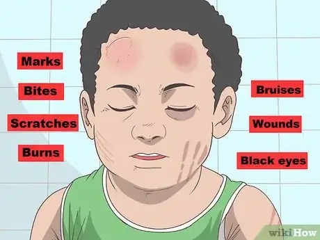 Image titled Recognize Signs of Abuse in a Toddler or Baby Step 10