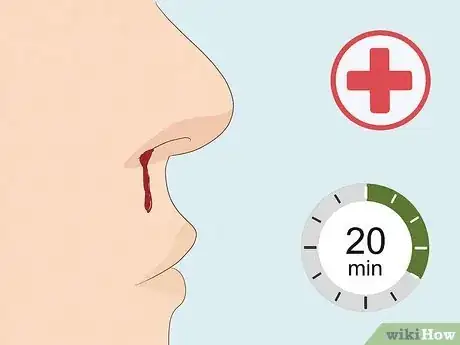 Image titled Stop a Nosebleed with a Penny Step 9