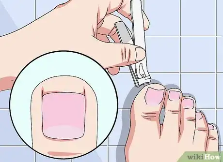 Image titled Use Nail Clippers Step 8