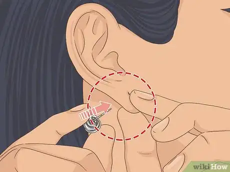 Image titled Put Your Earring Back when It Won't Go in Step 6