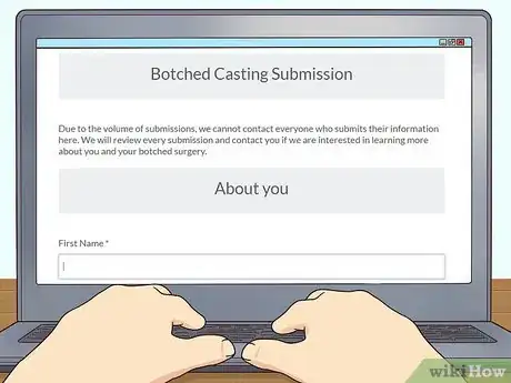 Image titled Get Cast for the TV Show Botched Step 8
