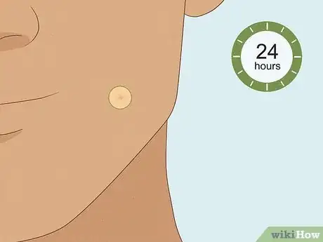 Image titled What to Do After Removing Pimple Patch Step 13