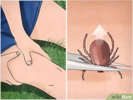 Image titled Get Rid of Ticks Around Your Home Step 16