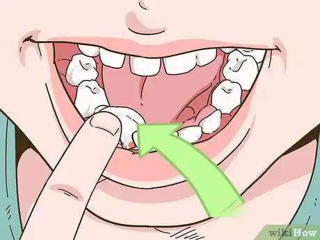 Image titled Painlessly Pull Out a Loose Baby Tooth Step 10