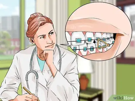 Image titled Connect a Rubber Band to Your Braces Step 7