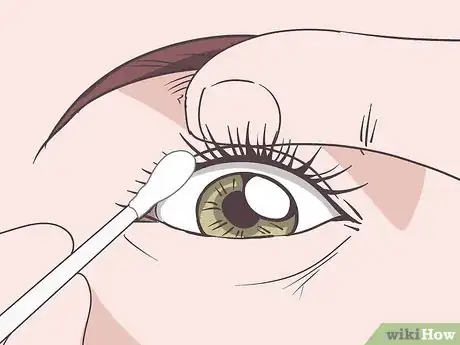 Image titled Treat Dry Eyelids Step 2