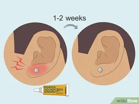 Image titled Reduce Pain Caused by a New Piercing Step 15