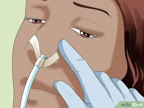 Image titled Insert a Nasogastric (NG) Tube Step 14