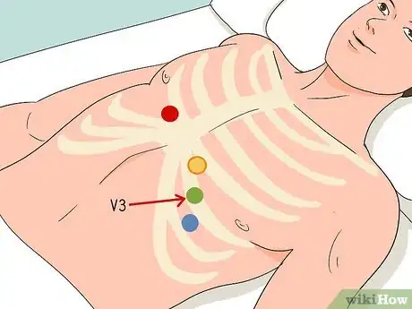 Image titled Put ECG Leads on a Chest Step 9