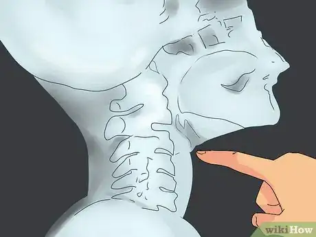 Image titled Get a Fish Bone Out of Your Throat Step 3