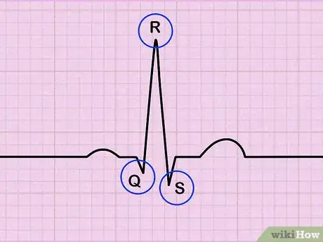 Image titled Read an EKG Step 2