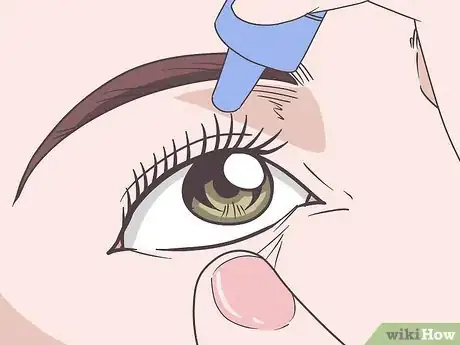 Image titled Treat Dry Eyelids Step 3
