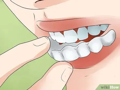 Image titled Clean Invisalign Step 1