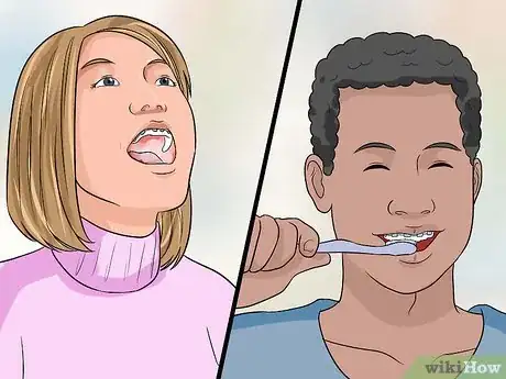 Image titled Choose the Color of Your Braces Step 8