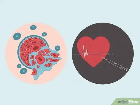 Image titled Treat Tumors in Hamsters Step 7