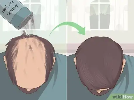 Image titled Hide Alopecia Step 4