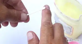 Remove Nail Polish from Skin