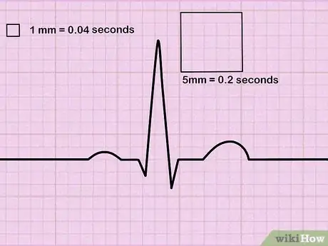 Image titled Read an EKG Step 1