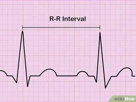 Image titled Read an EKG Step 5