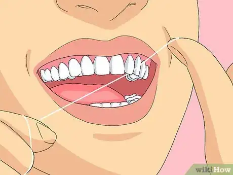 Image titled Clean Invisalign Step 4