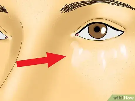 Image titled Reduce Puffiness from Crying Step 6