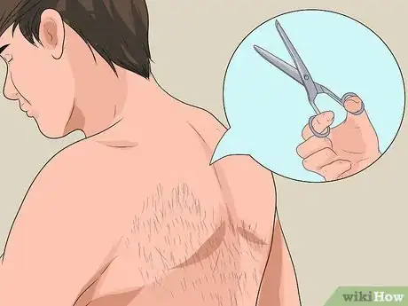 Image titled Get Rid of Back Hair Step 1