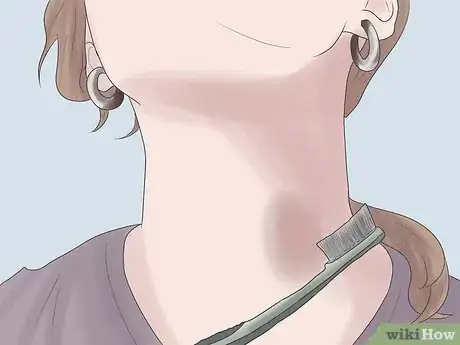 Image titled Get Rid of a Hickey Fast Step 4