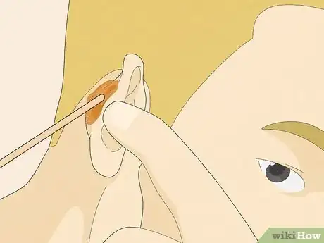 Image titled Wax Ear Hairs Step 10