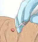 Remove Warts on Dogs