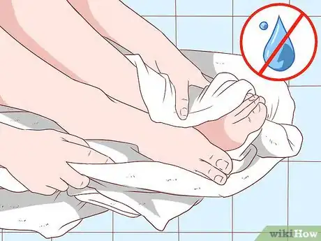 Image titled Get Rid of Calluses on Feet Step 8