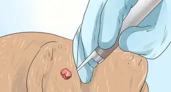 Remove Warts on Dogs