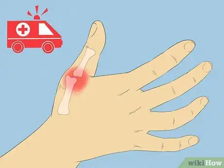 Image titled Prevent Arthritis in Your Hands Step 5